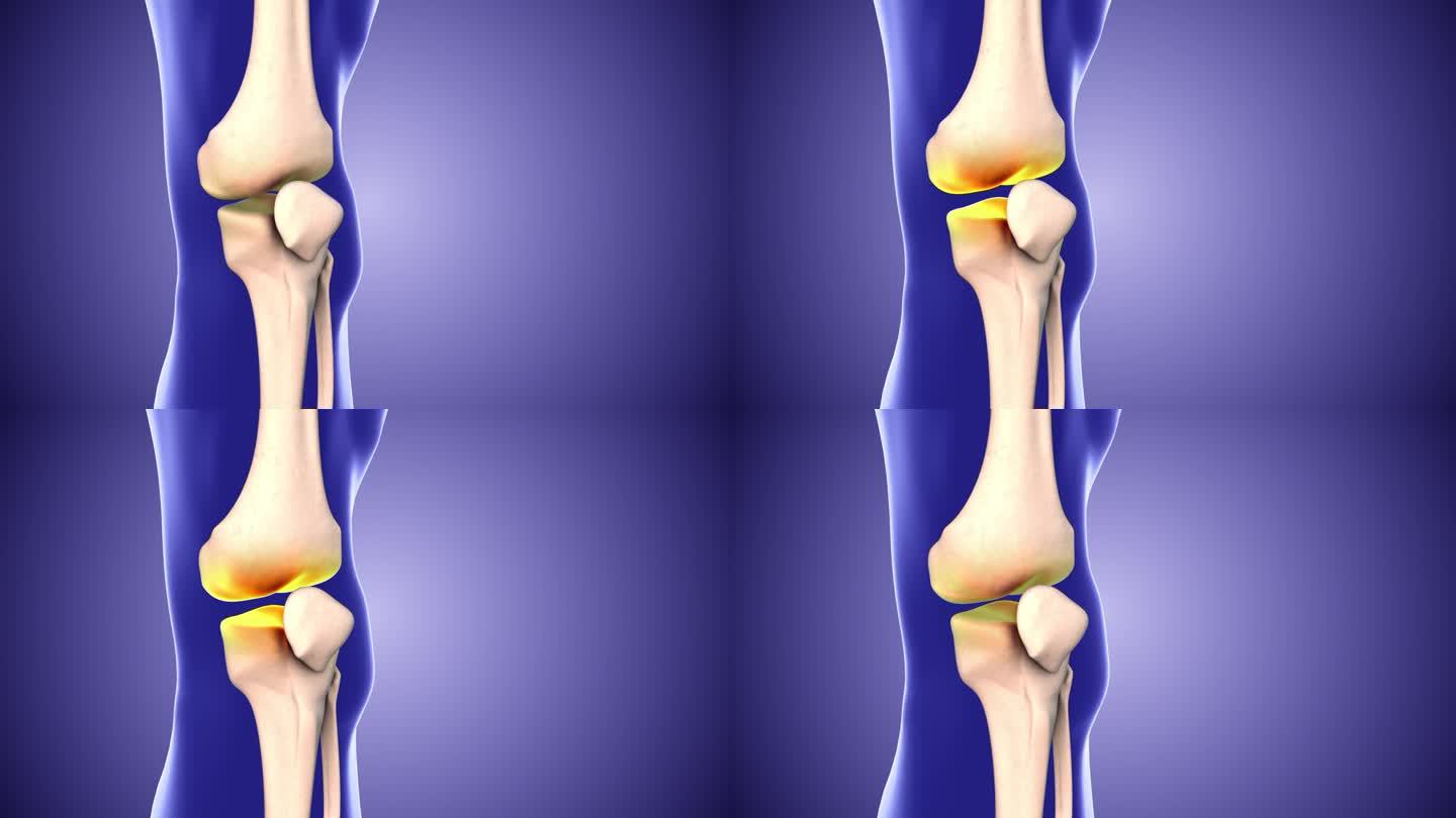 膝关节疼痛和膝关节间隙