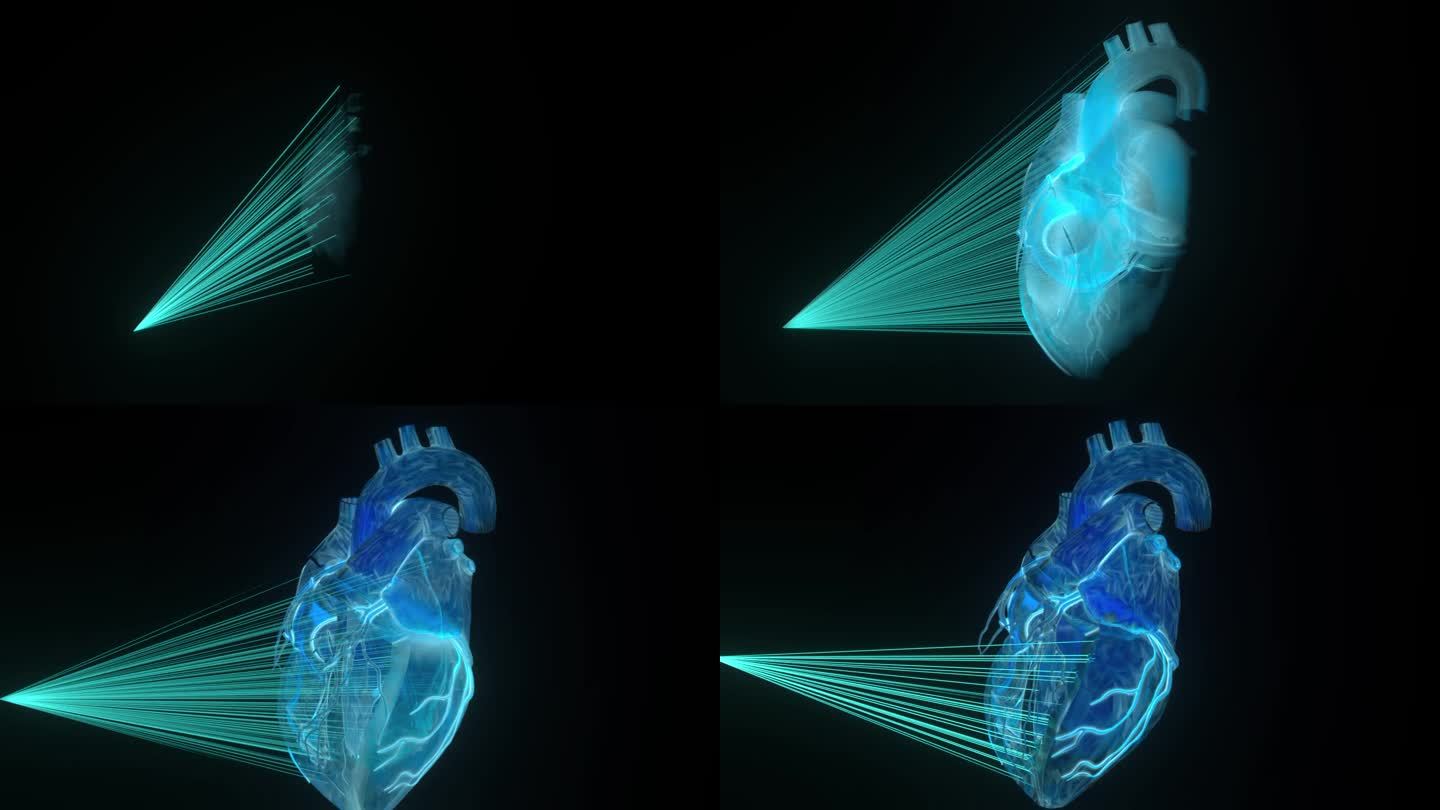 不要XP，扫描心脏C4D科技激光