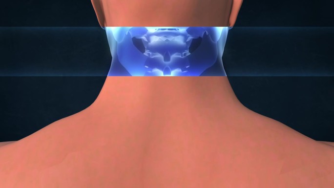 人体颈部的x光片