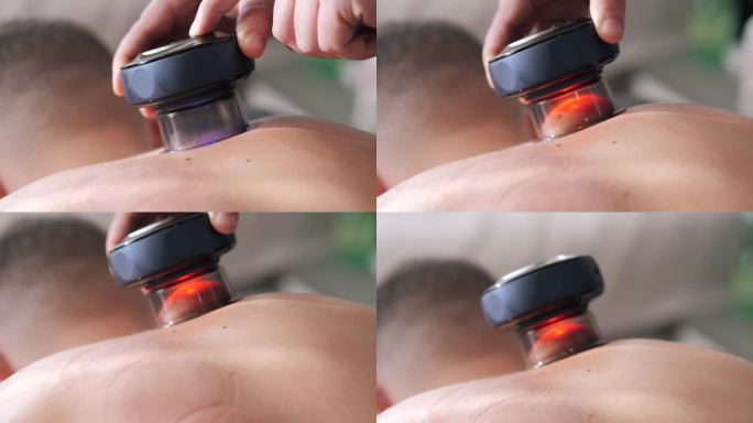 治疗师使用现代技术便携式电子设备对患者背部进行真空按摩，以改善淋巴引流和更新