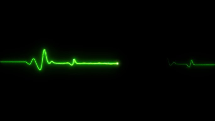 4K绿色粒子心率心电图跳动停止循环素材