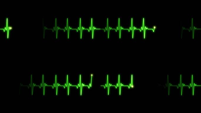 4K绿色心率心电图跳动停止循环素材