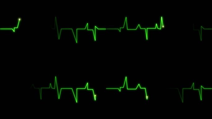4K绿色心率心电图跳动停止循环素材