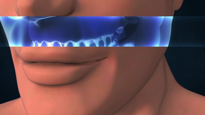 人类牙腔的x光照片