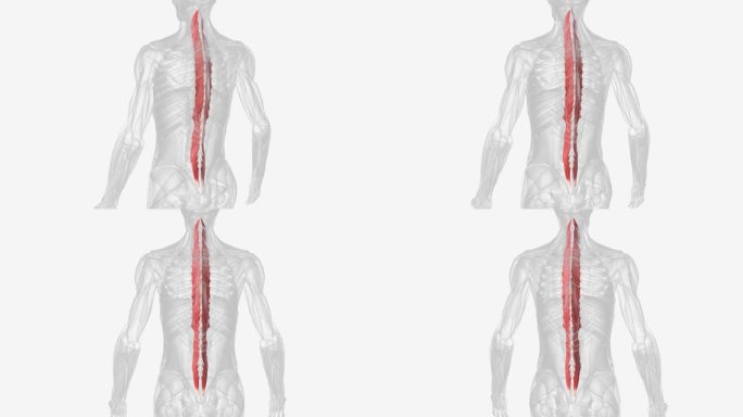 多裂肌是腰椎的重要稳定器。