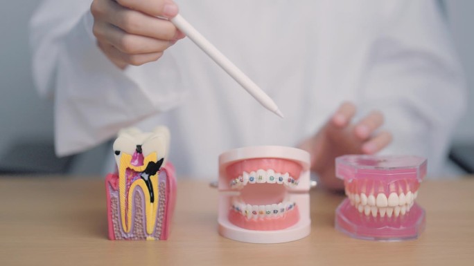 牙台上的牙齿解剖与正畸模型。口腔牙齿和疾病。三月口腔健康，牙医日，假牙。牙痛及儿童牙齿健康月及五月正