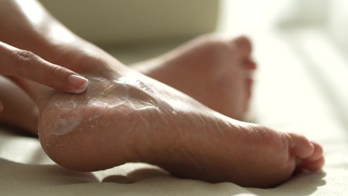 在这张剪短的照片中，一位中年亚洲女性在她干裂的脚跟上擦乳液霜