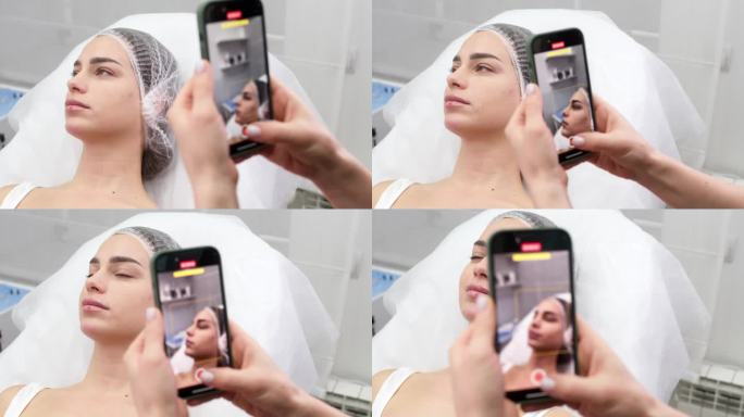 美容师用手机拍摄客户面部比例的照片。前后的结果。美容诊所。美容注射，手术服务。