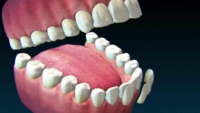 上颌犬齿种植体置换过程。