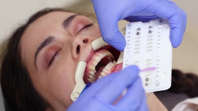 白人妇女在牙科诊所就诊时牙齿上系带牙套的近照。牙合错误的正畸矫正。正畸治疗的概念