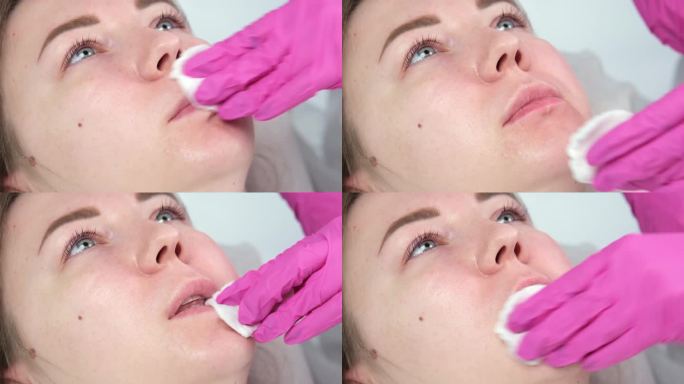 美容师在病人的嘴唇上进行麻醉，在注射透明质酸之前进行麻醉。在注射之前，要涂上一层麻醉药膏。