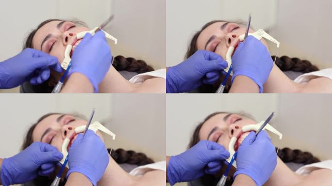 年轻的白人妇女坐在牙科办公室的椅子上，嘴里叼着牙牵开器。牙医为治疗准备牙齿。正畸学和牙科的概念
