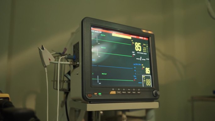 显示病人心率的生命体征的计算机监视器