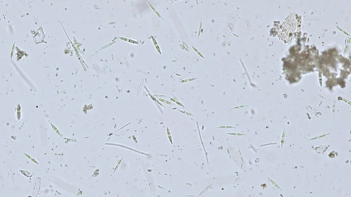 显微镜下的河流淡水硅藻——光学显微镜x200倍放大