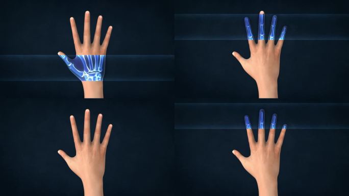 人手的x光片。