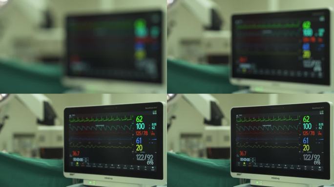 4K 60帧【手术室】心脏监护仪屏幕