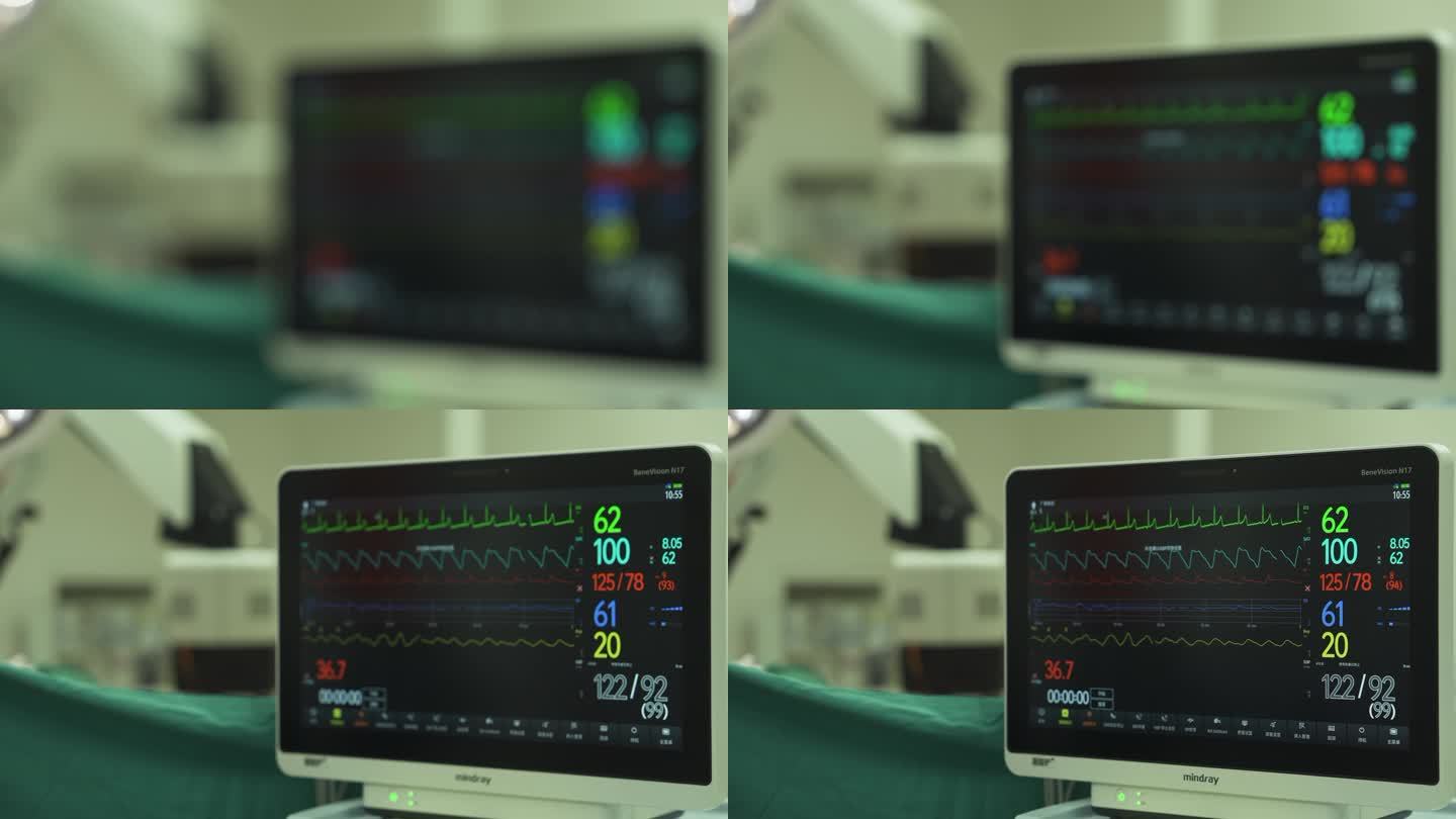 4K 60帧【手术室】心脏监护仪屏幕