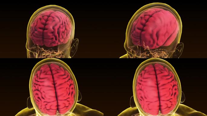 顶视图大脑与阿尔法哑光。神经系统疾病、肿瘤和脑外科