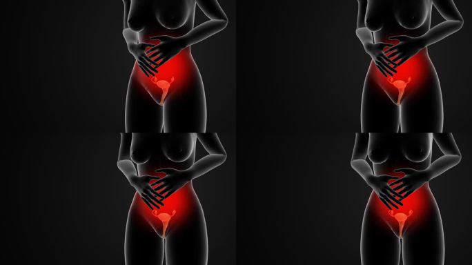 女性经期痉挛和疼痛的医学动画