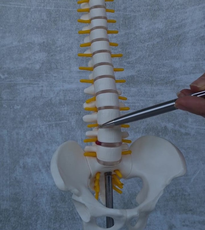 颈椎椎间疝及纤维环破裂