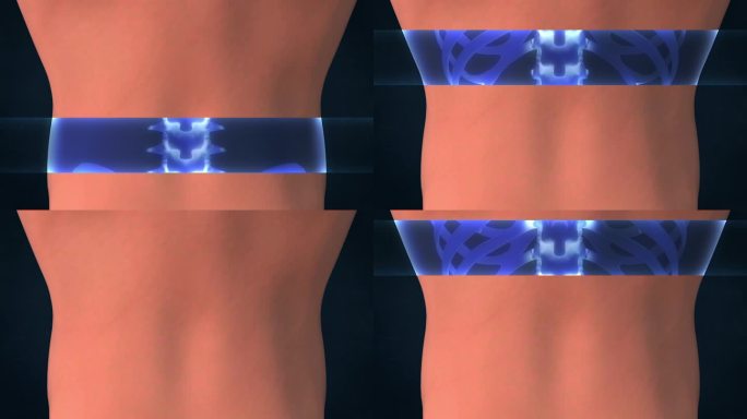 人体脊柱的x光片。