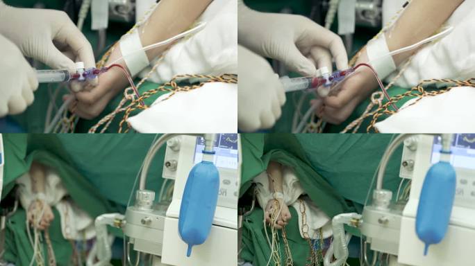4K 60帧【手术室】手术室抽血 呼吸机