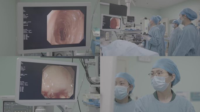 医生进行胃肠镜各种微创手术合集