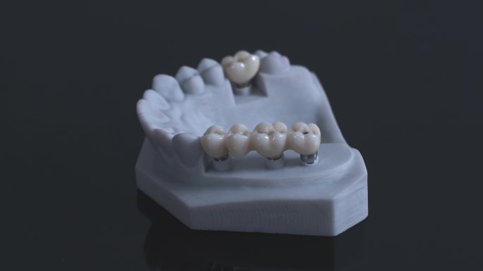 T0833假牙产品展示 义齿模型口腔整形