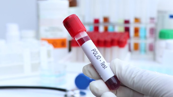脊髓灰质炎测试来检测血液中的异常