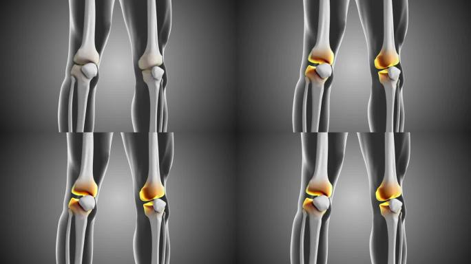 膝关节之间有间隙，膝关节不适