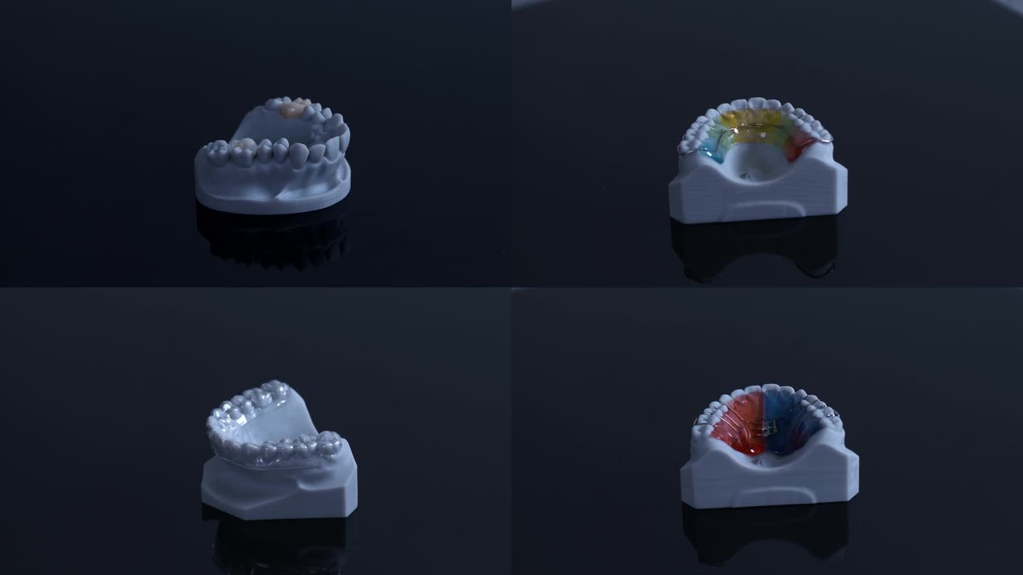 T0832义齿产品展示 高端牙套 口腔