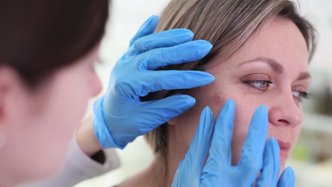 皮肤科医生检查女性患者面部皮肤侵蚀性肿瘤的特写4k电影