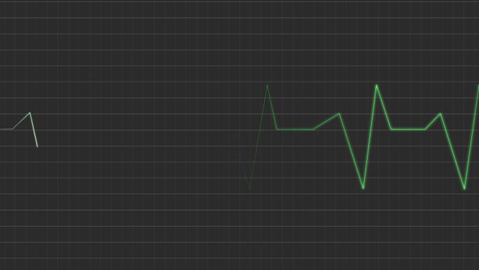 4种不同的心电图特效
