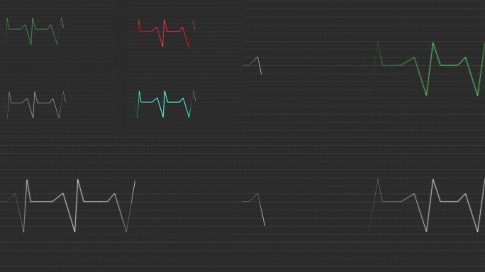 4种不同的心电图特效
