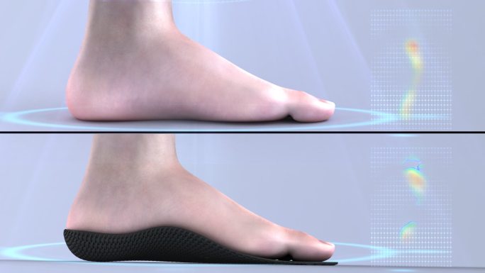 鞋垫 科技 脚 弓形 生长发育