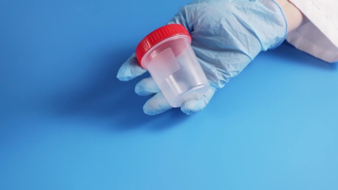 精子捐赠，装着男性精液样本的罐子，用于受精和怀孕，生孩子，在一个蓝色背景的生殖诊所的医生手中