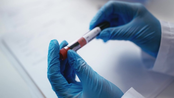 实验室助理检查艾滋病毒检测呈阳性的试管，并做笔记