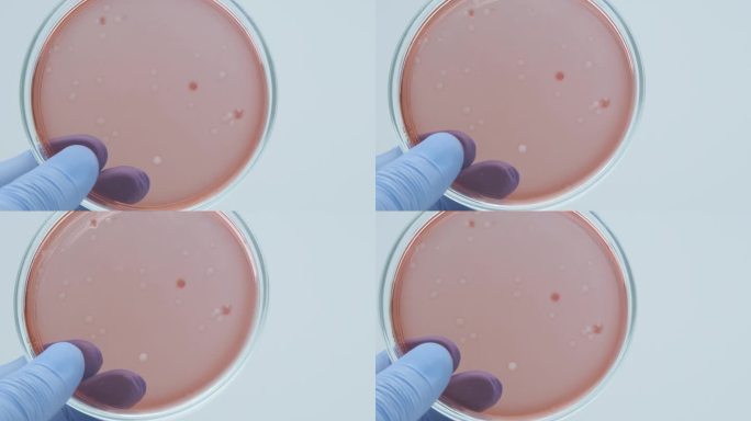 细菌在培养皿中培养。