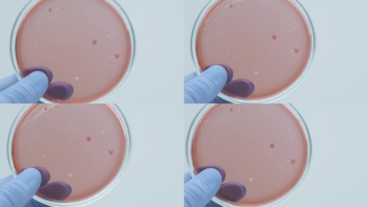 细菌在培养皿中培养。