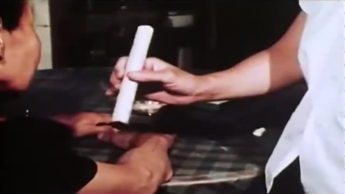60年代的中医针灸艾灸视频