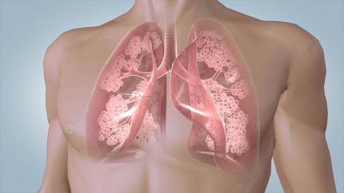 【4K透明通道】肺部感染恢复健康