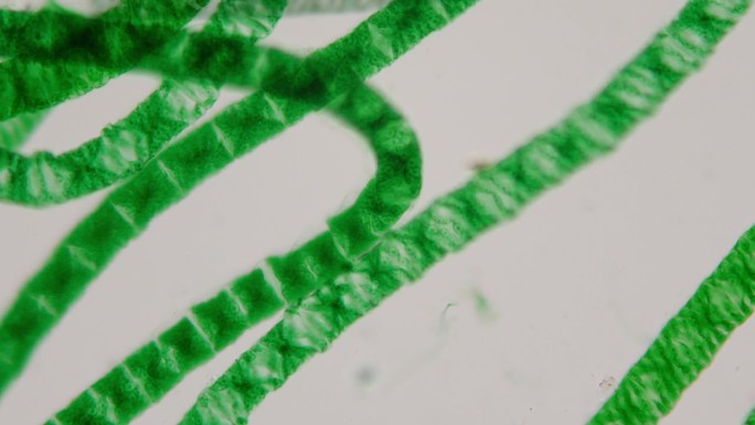 显微镜下的螺旋体。叶绿体螺旋。放大400倍。是地球上淡水水体中最常见的藻类。水华