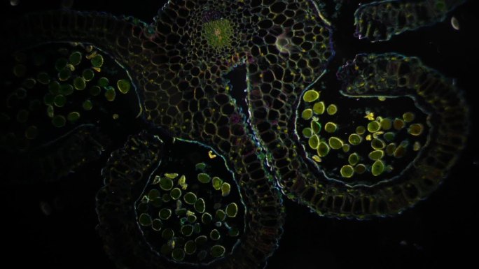 显微镜下雄蕊或花药。百合雄蕊的横切面，有四个被绒毡层包围的房室。植物中的有性生殖。100倍放大