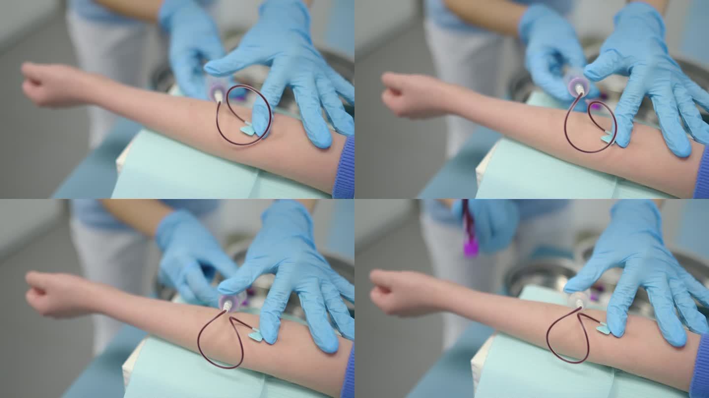 一名护士用蝴蝶针给一个孩子采血。在现代实验室或医院采集血液样本进行检查时，一个男孩的手的特写视频。