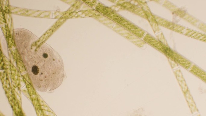 纤毛虫和绿藻，显微镜，