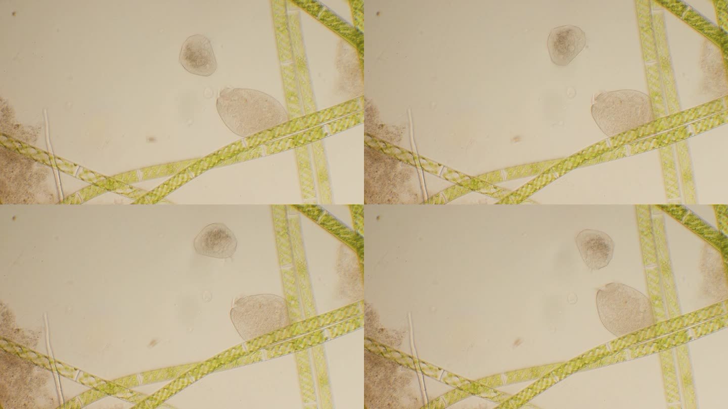 纤毛虫和绿藻，显微镜，