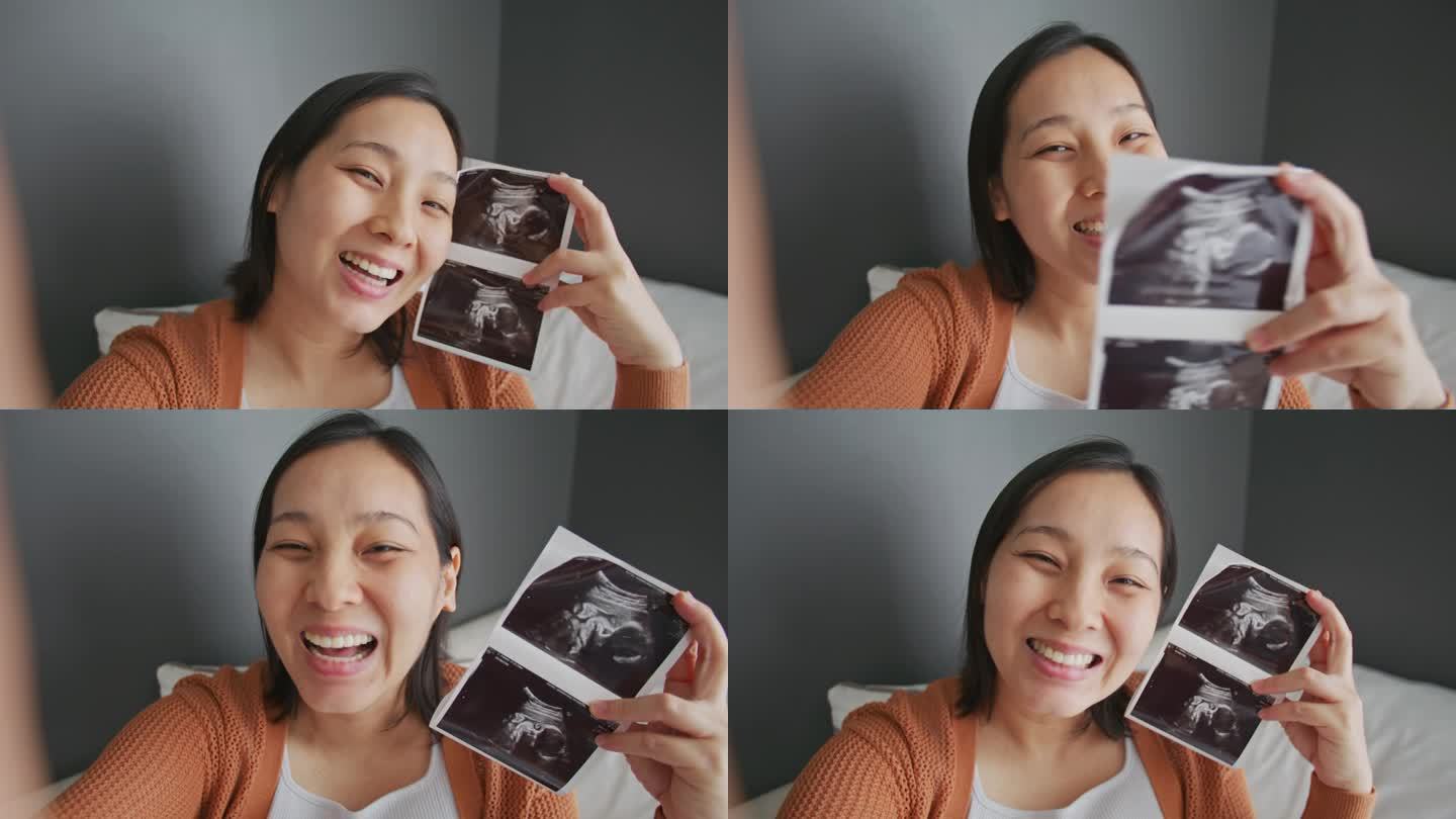 一位孕妇在视频通话中展示了超声图像