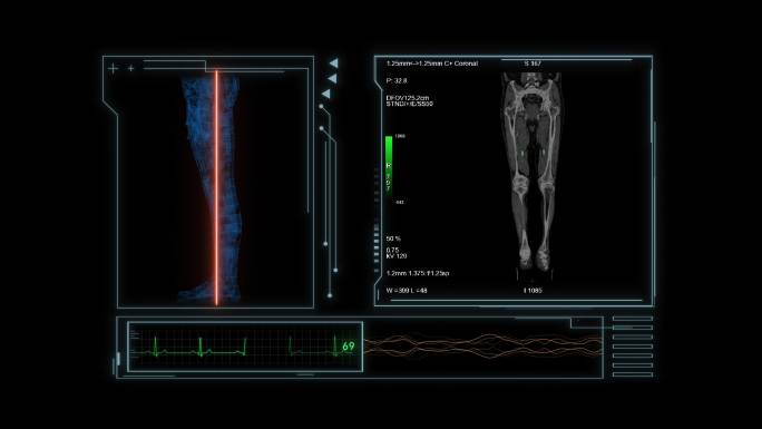 人体各部位CT扫描科技动画