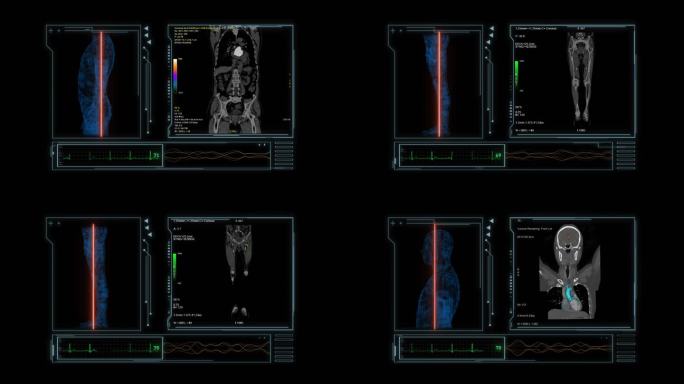 人体各部位CT扫描科技动画