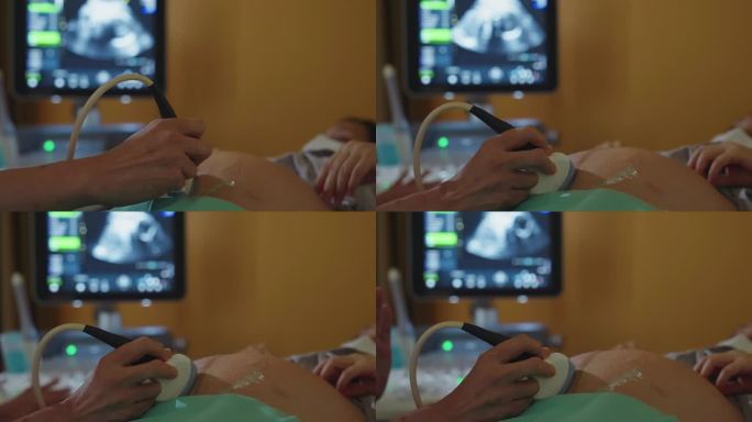 孕妇在医生办公室做超声波检查